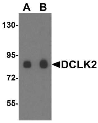 Western Blot: DCAMKL2 AntibodyBSA Free [NBP1-77128]