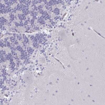 Immunohistochemistry-Paraffin: DCBLD1 Antibody [NBP2-32487]