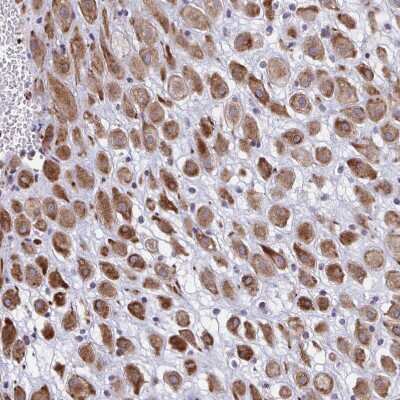 Immunohistochemistry-Paraffin: DCBLD1 Antibody [NBP2-32487]