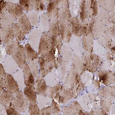 Immunohistochemistry-Paraffin: DCBLD1 Antibody [NBP2-32487]