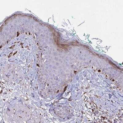 Immunohistochemistry-Paraffin: DCBLD1 Antibody [NBP2-32487]