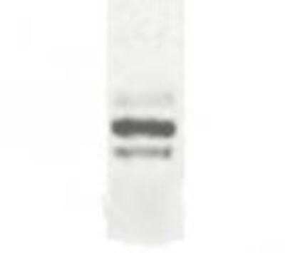 Western Blot: DCBLD2/ESDN AntibodyBSA Free [NB100-93567]