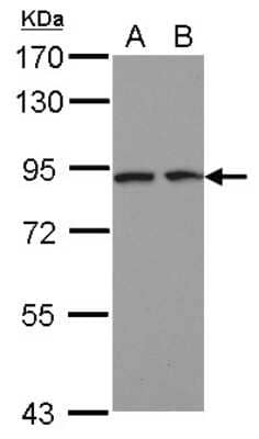 Western Blot: DCBLD2/ESDN Antibody [NBP2-16105]