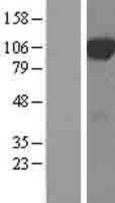 Western Blot: DCBLD2/ESDN Overexpression Lysate [NBL1-09737]