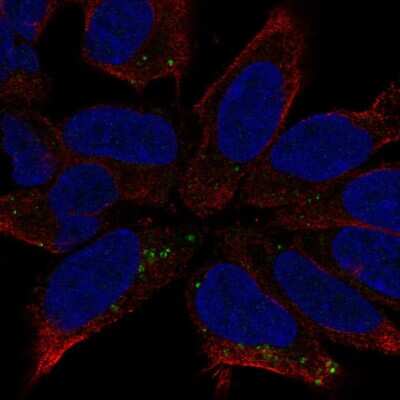 Immunocytochemistry/ Immunofluorescence: DCC Antibody [NBP2-56793]