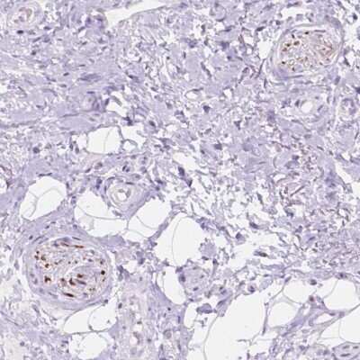 Immunohistochemistry: DCC Antibody [NBP2-49606]