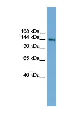 Western Blot: DCC Antibody [NBP1-56988]