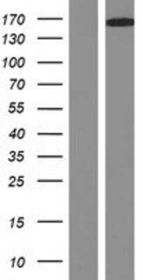 Western Blot: DCC Overexpression Lysate [NBP2-07775]