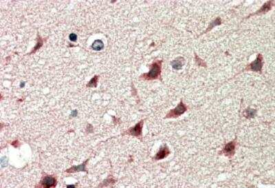 Immunohistochemistry-Paraffin: DCDC2 Antibody [NB100-2806]
