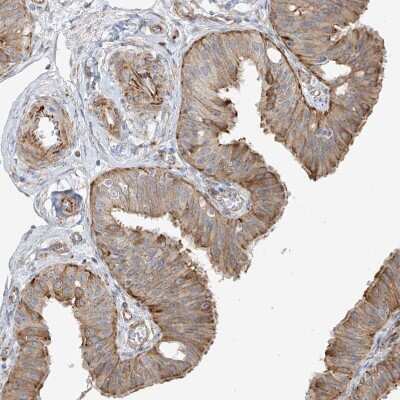 Immunohistochemistry-Paraffin: DCDC2 Antibody [NBP1-84298]