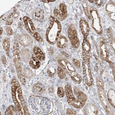 Immunohistochemistry-Paraffin: DCDC2 Antibody [NBP1-84298]