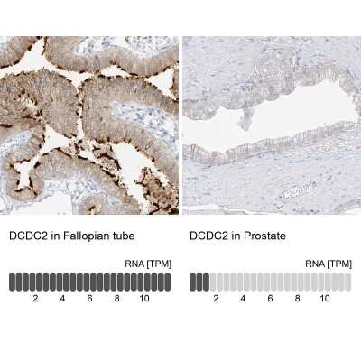 Immunohistochemistry-Paraffin: DCDC2 Antibody [NBP2-38184]