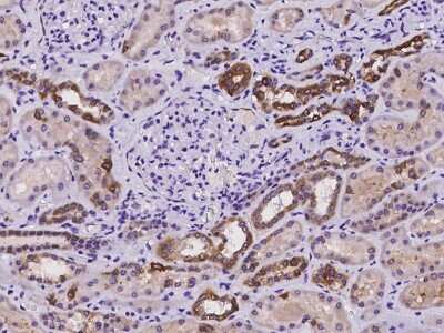 Immunohistochemistry-Paraffin: DCDC2 Antibody [NBP2-97244]