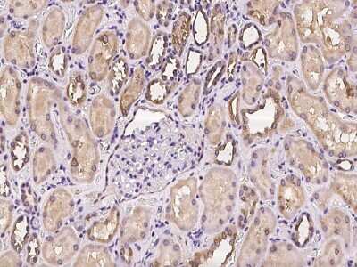 Immunohistochemistry-Paraffin: DCDC2 Antibody [NBP2-97256]