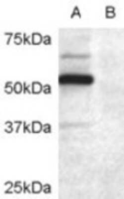 Western Blot: DCDC2 Antibody [NB100-2806]