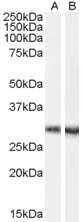 Western Blot: DCDC2 Antibody [NB100-53803]