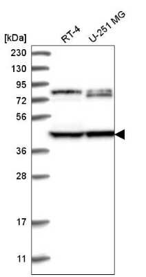 Western Blot: DCDC2 Antibody [NBP2-55048]