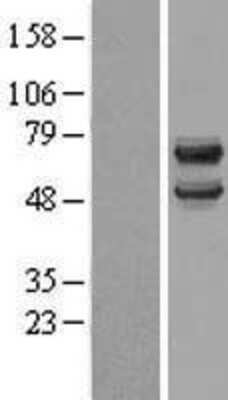 Western Blot: DCDC2 Overexpression Lysate [NBL1-09739]