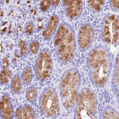 Immunohistochemistry-Paraffin: DCDC2B Antibody [NBP1-94179]