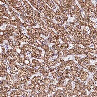 Immunohistochemistry-Paraffin: DCDC2C Antibody [NBP1-94180]