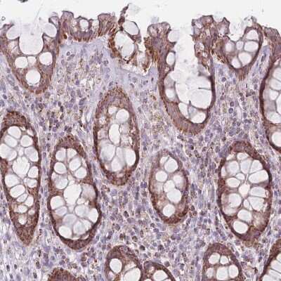 Immunohistochemistry-Paraffin: DCHS1 Antibody [NBP2-13902]