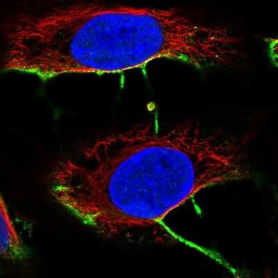 Immunocytochemistry/ Immunofluorescence: DCHS2 Antibody [NBP2-38046]