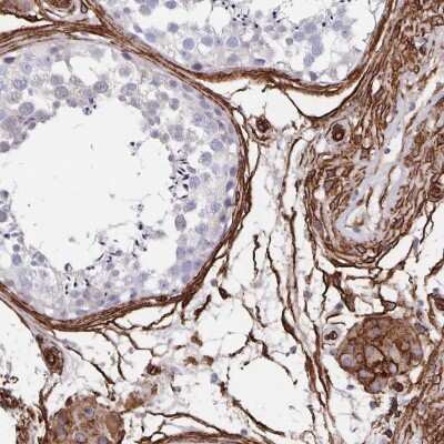 Immunohistochemistry-Paraffin: DCHS2 Antibody [NBP2-38046]