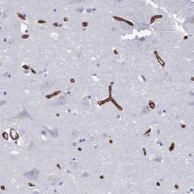 Immunohistochemistry-Paraffin: DCHS2 Antibody [NBP2-38046]