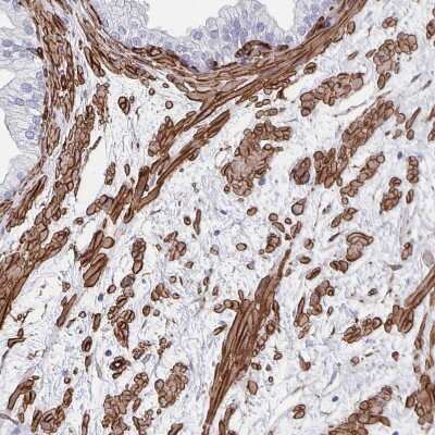 Immunohistochemistry-Paraffin: DCHS2 Antibody [NBP2-38046]