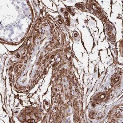 Immunohistochemistry-Paraffin: DCHS2 Antibody [NBP2-38046]