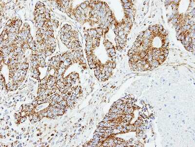 Immunohistochemistry-Paraffin: DCI Antibody [NBP1-31549]