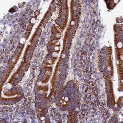 Immunohistochemistry-Paraffin: DCI Antibody [NBP1-91821]