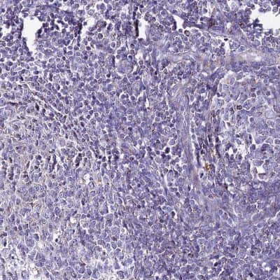 Immunohistochemistry-Paraffin: DCI Antibody [NBP1-91821]