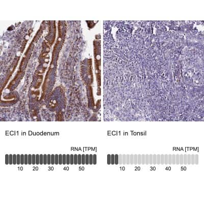Immunohistochemistry-Paraffin: DCI Antibody [NBP1-91821]