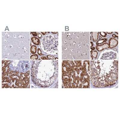 Immunohistochemistry-Paraffin: DCI Antibody [NBP1-91821]