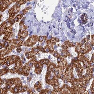 Immunohistochemistry-Paraffin: DCI Antibody [NBP1-91821]