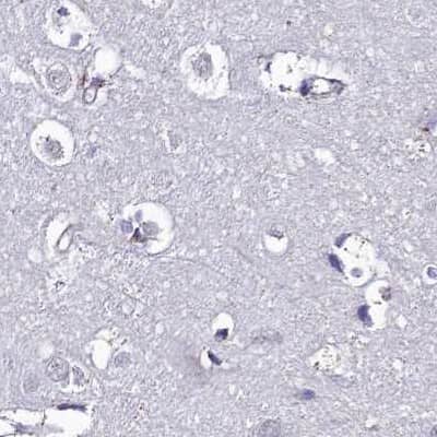 Immunohistochemistry-Paraffin: DCI Antibody [NBP1-91821]