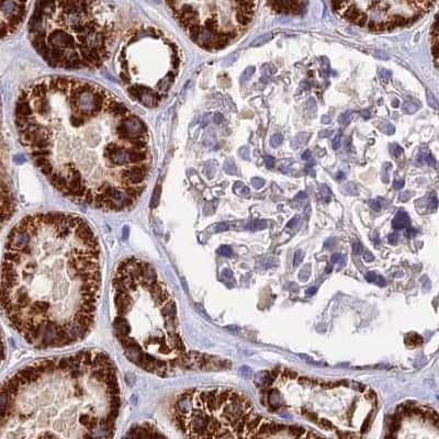 Immunohistochemistry-Paraffin: DCI Antibody [NBP1-91821]
