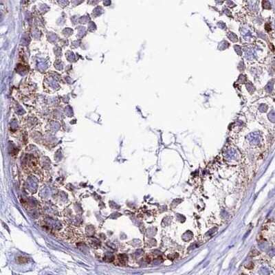 Immunohistochemistry-Paraffin: DCI Antibody [NBP1-91821]