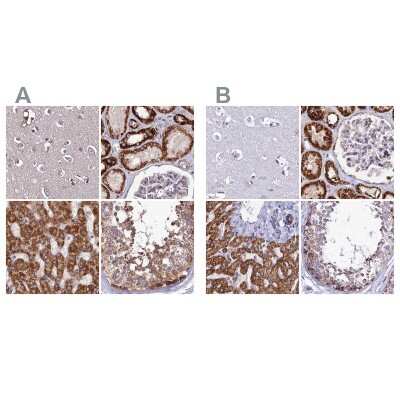 Immunohistochemistry-Paraffin: DCI Antibody [NBP1-91822]