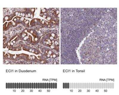 Immunohistochemistry-Paraffin: DCI Antibody [NBP1-91822]