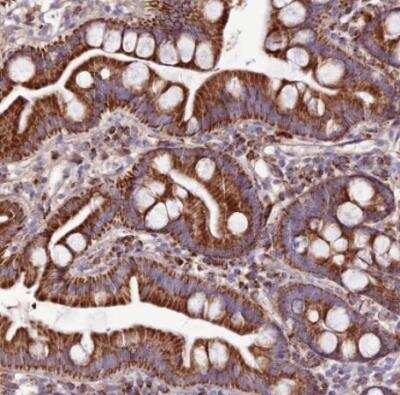 Immunohistochemistry-Paraffin: DCI Antibody [NBP1-91822]