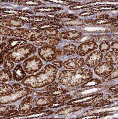 Immunohistochemistry-Paraffin: DCI Antibody [NBP1-91822]