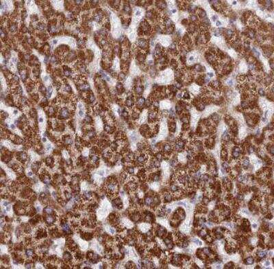 Immunohistochemistry-Paraffin: DCI Antibody [NBP1-91822]