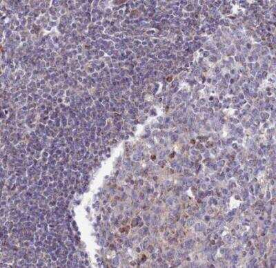Immunohistochemistry-Paraffin: DCI Antibody [NBP1-91822]