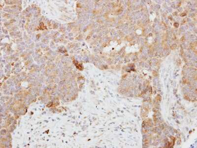 Immunohistochemistry-Paraffin: DCI Antibody [NBP2-16107]