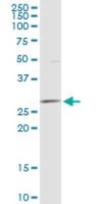 Western Blot: DCI Antibody [H00001632-B01P]