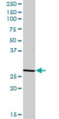 Western Blot: DCI Antibody [H00001632-B01P]