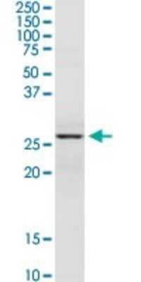 Western Blot: DCI Antibody [H00001632-D01P]