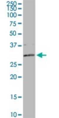 Western Blot: DCI Antibody [H00001632-D01P]